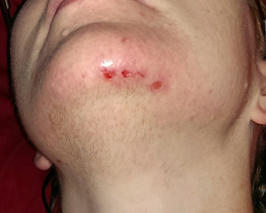milfs in joga pants how heal face facial skin damage